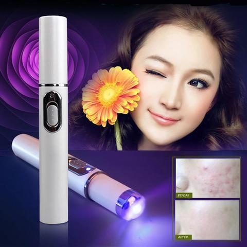 Blue Light Therapy Acne Laser Pen Soft Scar Wrinkle Removal Treatment Device Skin Ca
re Beauty Equipment - Nordic Beauty