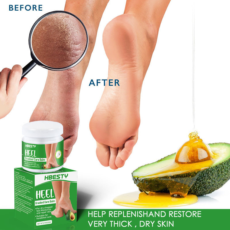 Avocado heel creams - Nordic Beauty